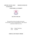 Medical doctorate thesis: Research about short and medium-term results of transcatheter closure of perimembranous VSD using the symmetrical double-disc device
