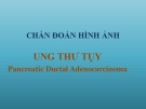 Bài giảng Chẩn đoán hình ảnh ung thư tụy