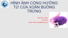 Bài giảng Hình ảnh cộng hưởng từ của xoắn buồng trứng - BS. Mai Thị Tú Uyên