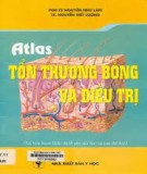 Điều trị tổn thương bỏng: Phần 2