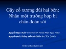 Bài giảng Gãy cổ xương đùi hai bên: Nhân một trường hợp bị chẩn đoán sót - BS. Nguyễn Ngọc Tuấn