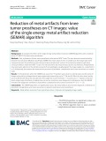 Reduction of metal artifacts from knee tumor prostheses on CT images: Value of the single energy metal artifact reduction (SEMAR) algorithm