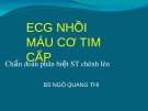 Bài giảng ECG 3: ECG nhồi máu cơ tim cấp - Phần 2