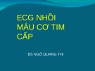 Bài giảng ECG 3: ECG nhồi máu cơ tim cấp - Phần 1