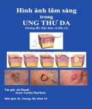 Một số hình ảnh lâm sàng trong ung thư da: Phần 1