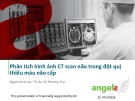 Bài giảng Phân tích hình ảnh CT scan não trong đột quỵ thiếu máu não cấp - ThS. BS. Võ Phương Trúc