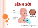 Bài giảng Bệnh sởi - BS.Trần Song Ngọc Châu