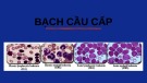 Bài giảng Bạch cầu cấp