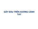 Bài giảng Gãy đầu trên xương cánh tay