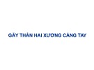 Bài giảng Gãy thân hai xương cẳng tay