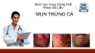 Bài giảng Mụn trứng cá - Bệnh viện Trung ương Huế