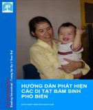 Các dị tật bẩm sinh phổ biến - Hướng dẫn cách phát hiện: Phần 2