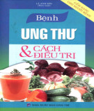 Phương pháp phòng và điều trị bệnh ung thư: Phần 2